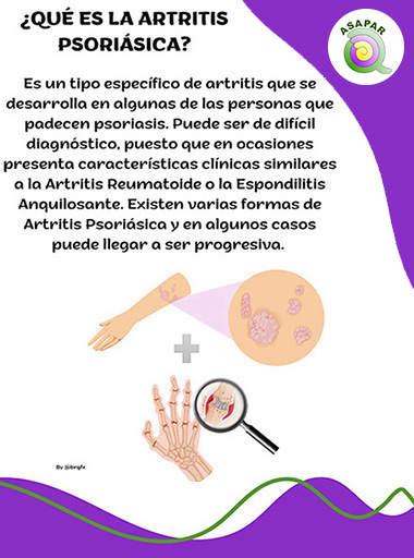 artritis psoriásica