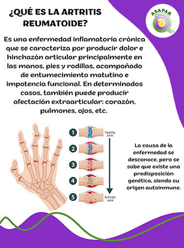 artritis reumatoide